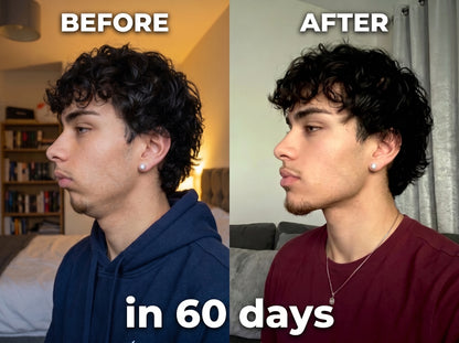 “Cut Quickly” Jaw Support Mouth Piece